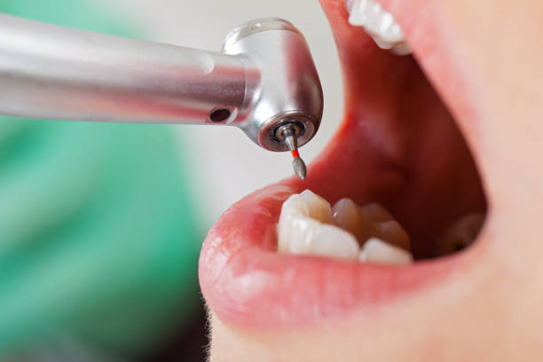 Best Emergency Wisdom Teeth Removal in Ridgeway, AK